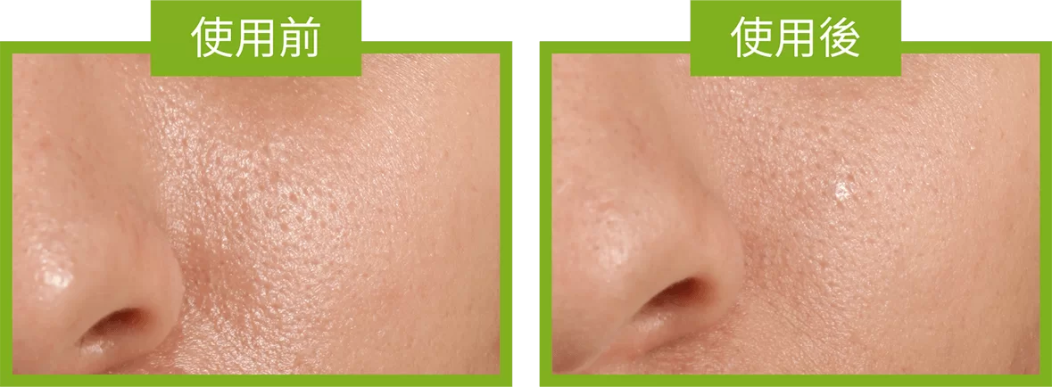 使用 Kiehl’s 亞瑪遜白泥磨砂潔面粉前後的分別