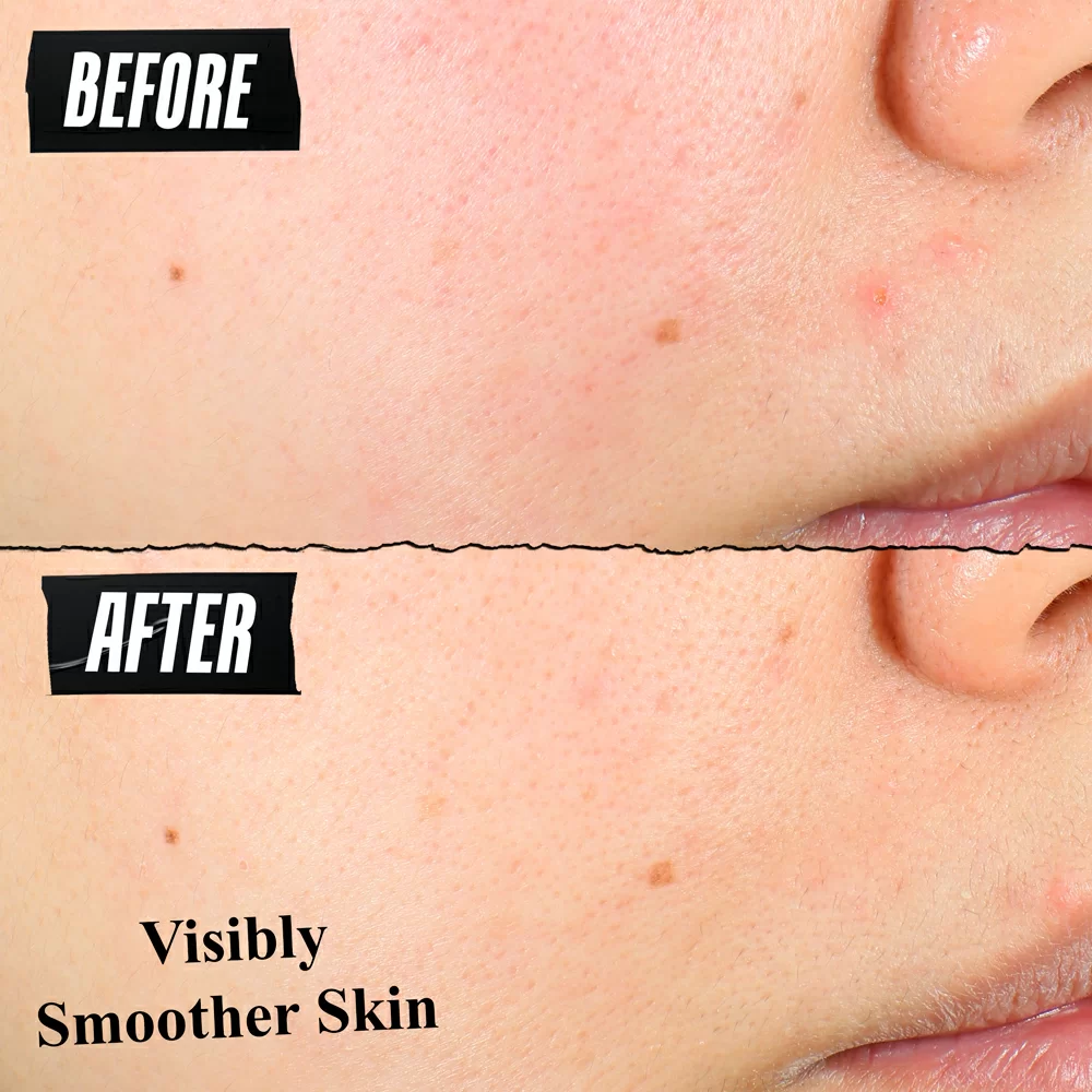 Clearly Corrective™ Daily Re-Texturizing Triple Acid Peel