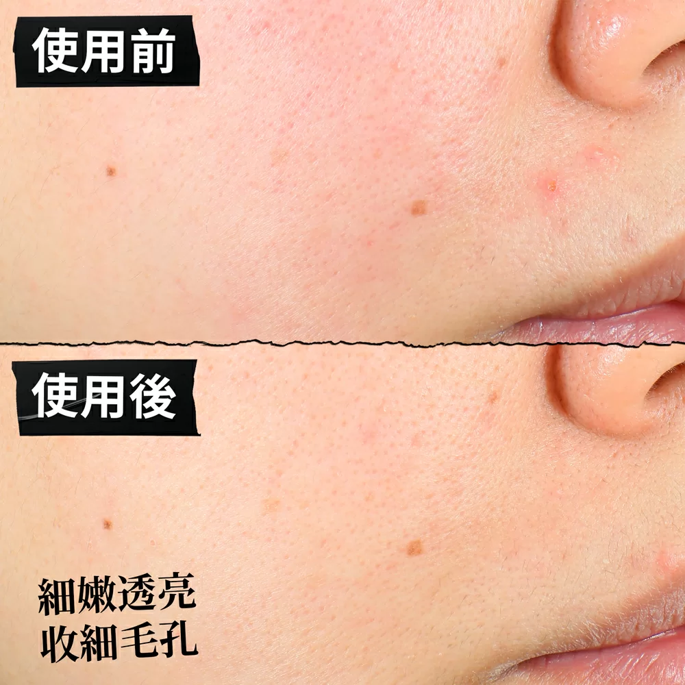 醫學三酸煥膚精華