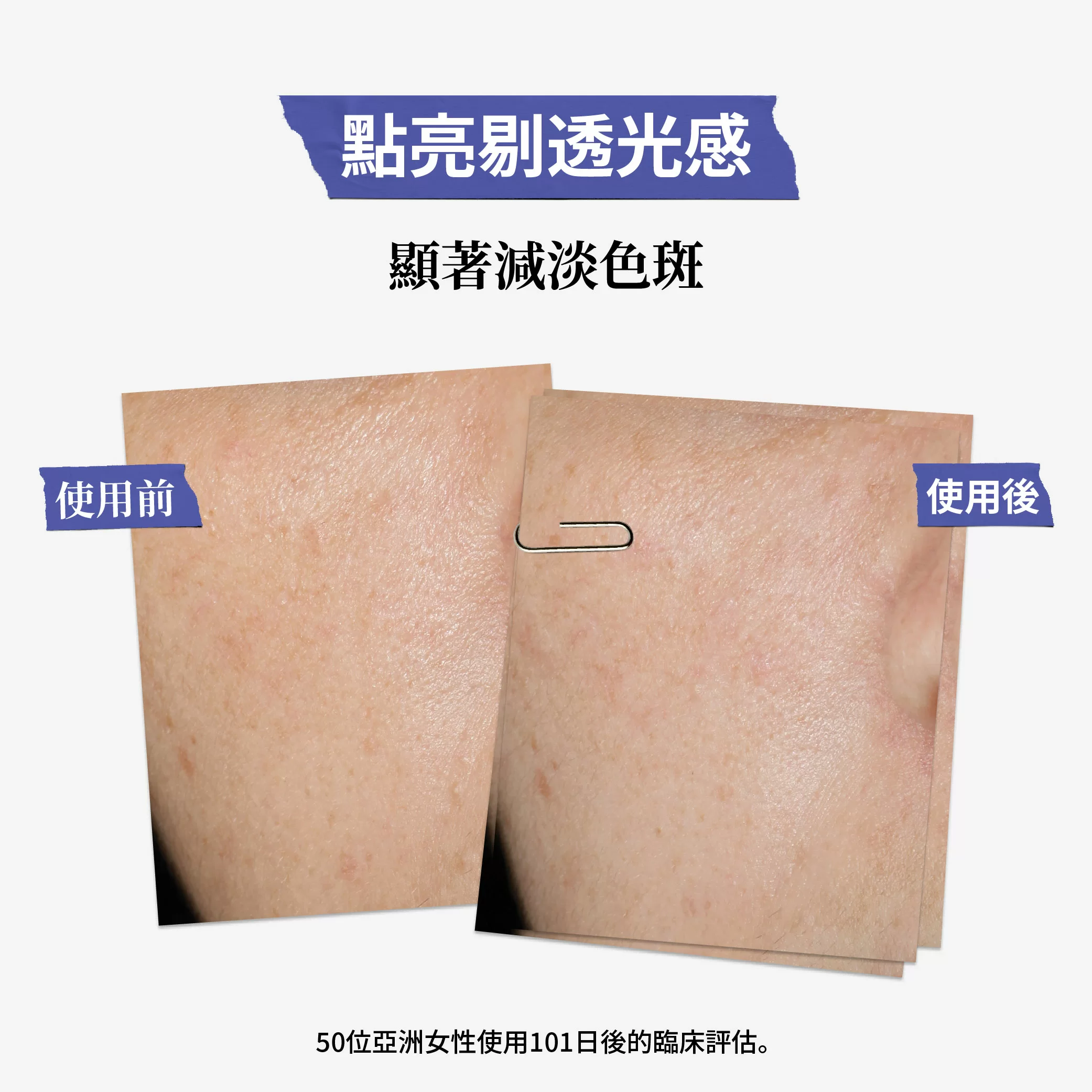 醫學維C淡斑精華