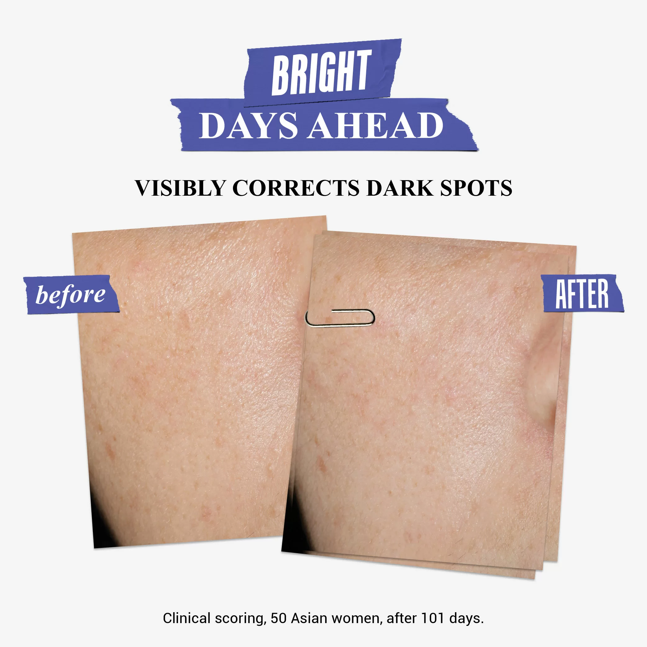 Clearly Corrective™ Dark Spot Solution