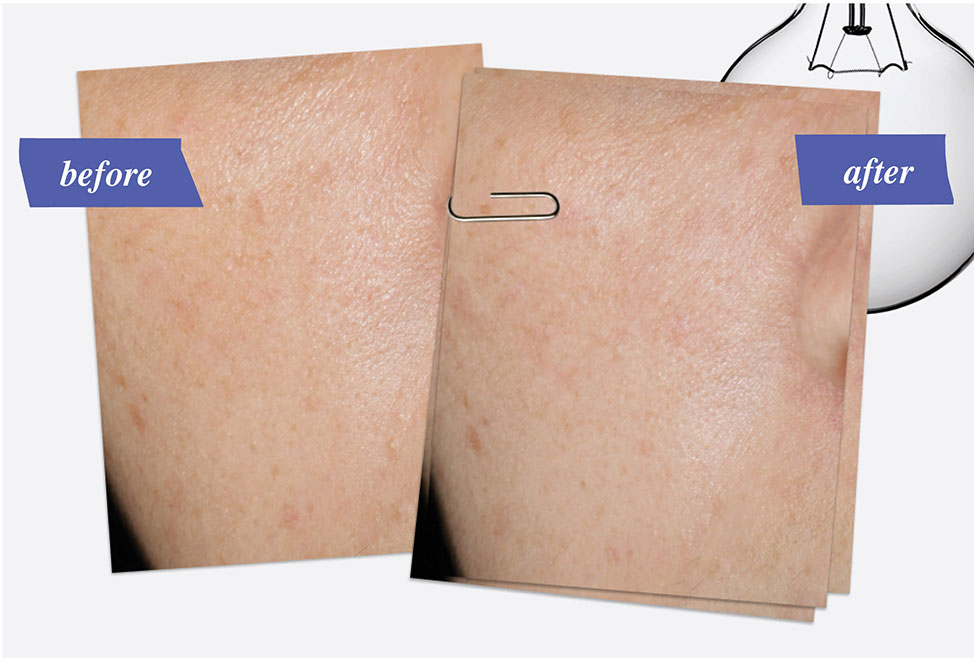 Clearly Corrective™ Dark Spot Solution - before use and after use